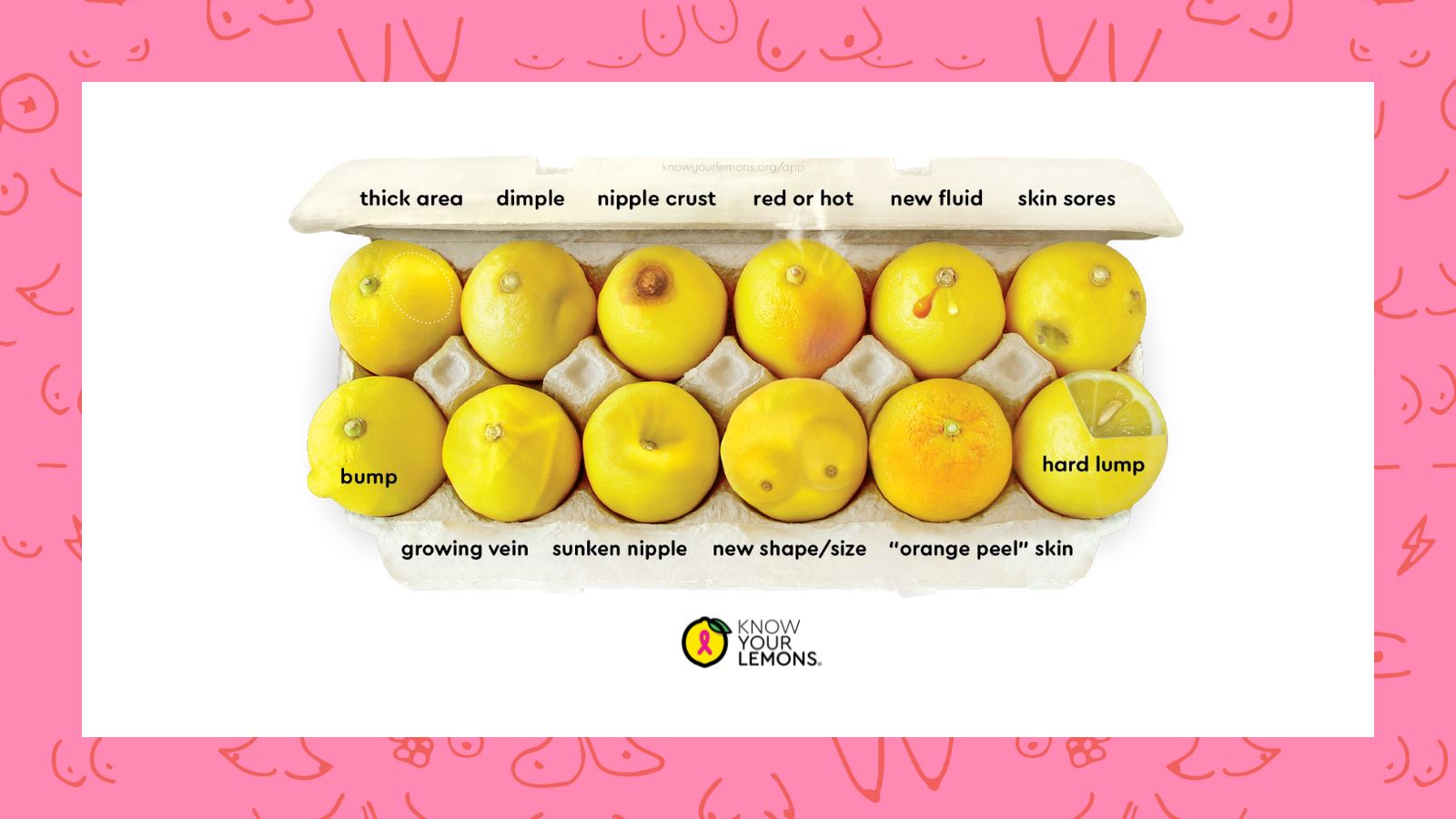 10 Facts and Statistics About Breast Cancer That we Learned from Know Your Lemons®